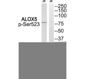 Western blot - ALOX5 (Phospho-Ser523) Antibody from Signalway Antibody (12128) - Antibodies.com