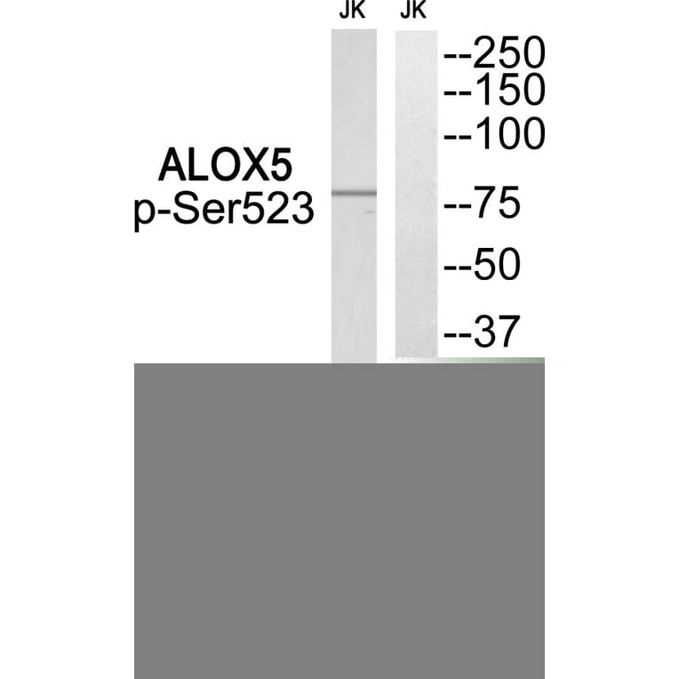 Western blot - ALOX5 (Phospho-Ser523) Antibody from Signalway Antibody (12128) - Antibodies.com