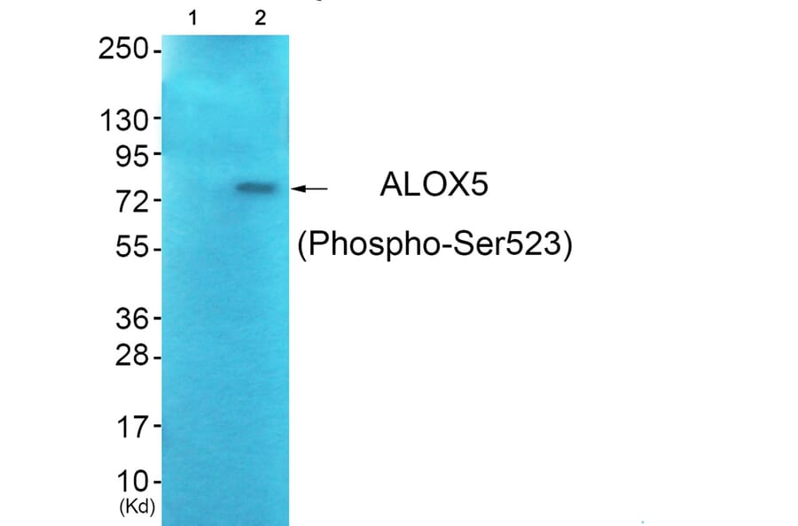 Western blot - ALOX5 (Phospho-Ser523) Antibody from Signalway Antibody (12128) - Antibodies.com