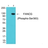 Western blot - FANCG (Phospho-Ser383) Antibody from Signalway Antibody (12138) - Antibodies.com