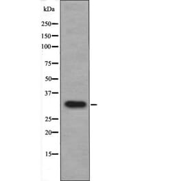 Western blot - DAPK1 (Phospho-Ser308) Antibody from Signalway Antibody (12429) - Antibodies.com