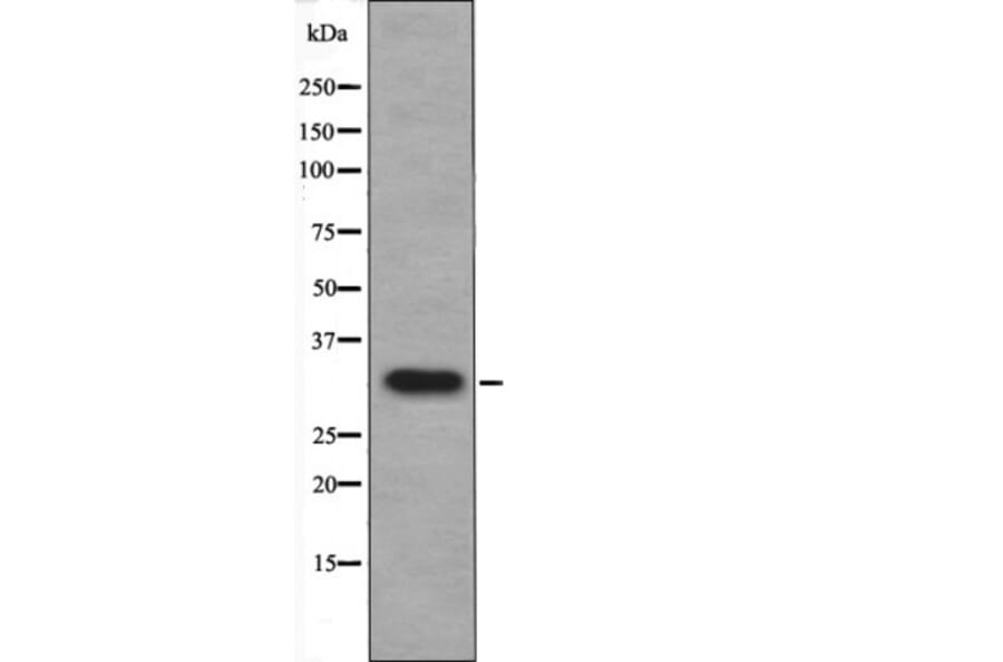 Western blot - DAPK1 (Phospho-Ser308) Antibody from Signalway Antibody (12429) - Antibodies.com