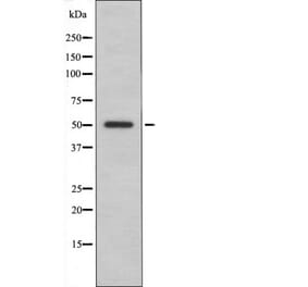 Western blot - ILK-1 (Phospho-Ser343) Antibody from Signalway Antibody (12444) - Antibodies.com