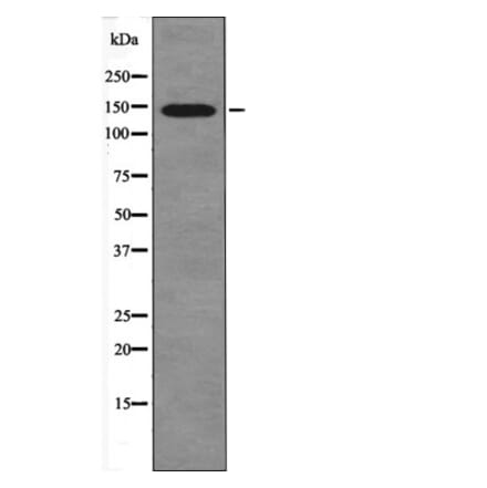 Western blot - eNOS (Phospho-Ser1179) Antibody from Signalway Antibody (12454) - Antibodies.com