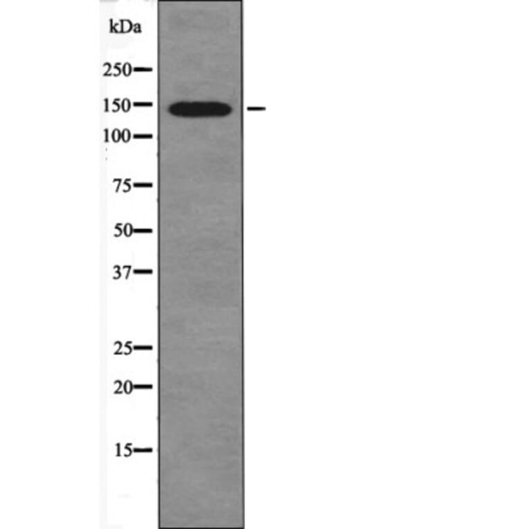 Western blot - eNOS (Phospho-Ser1179) Antibody from Signalway Antibody (12454) - Antibodies.com