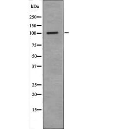 Western blot - RBBP8 (Phospho-Ser664) Antibody from Signalway Antibody (12461) - Antibodies.com