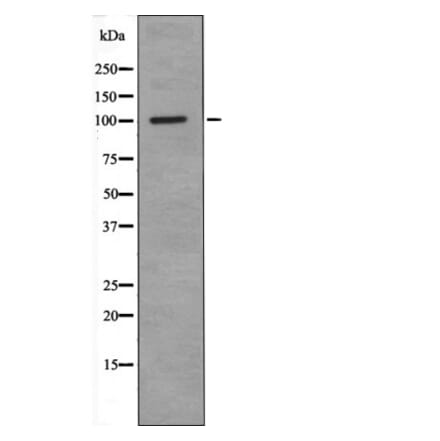 Western blot - RBBP8 (Phospho-Ser664) Antibody from Signalway Antibody (12461) - Antibodies.com
