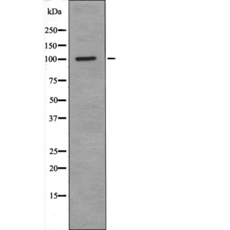 Western blot - RBBP8 (Phospho-Ser664) Antibody from Signalway Antibody (12461) - Antibodies.com