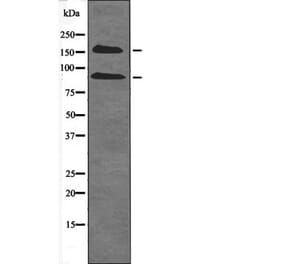 Western blot - IGF1R (Phospho-Tyr980) Antibody from Signalway Antibody (12478) - Antibodies.com