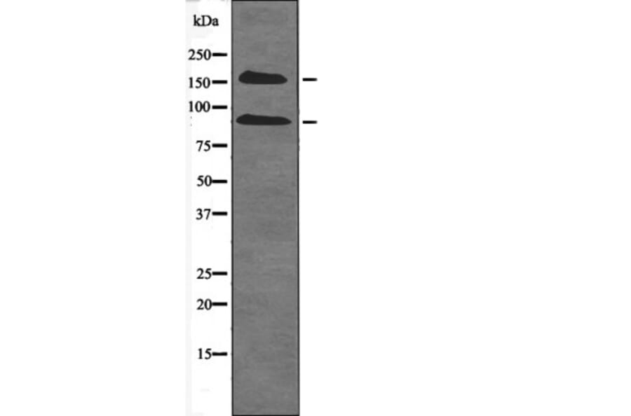 Western blot - IGF1R (Phospho-Tyr980) Antibody from Signalway Antibody (12478) - Antibodies.com