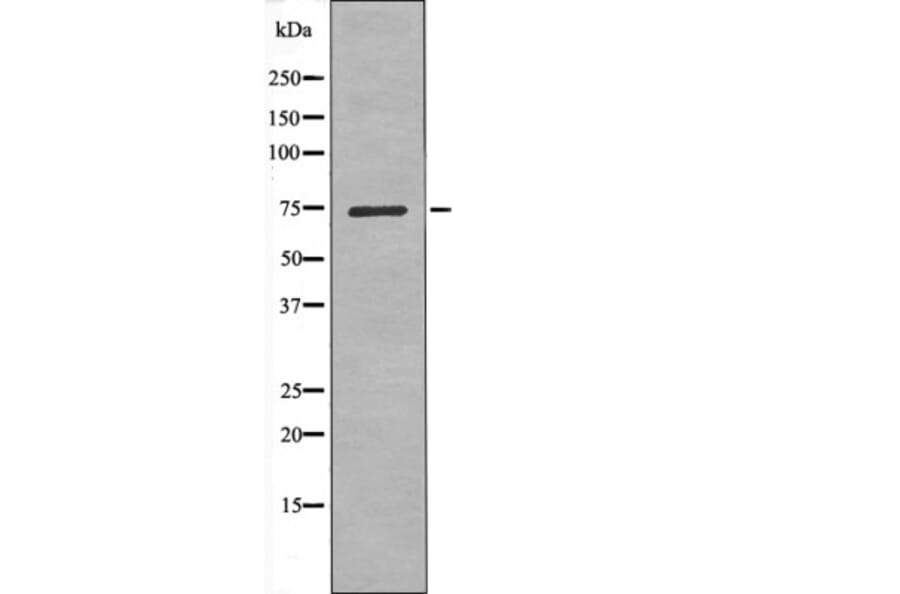 Western blot - LIMK1 (Phospho-Ser323) Antibody from Signalway Antibody (12479) - Antibodies.com