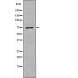 Western blot - LIMK1 (Phospho-Ser323) Antibody from Signalway Antibody (12479) - Antibodies.com