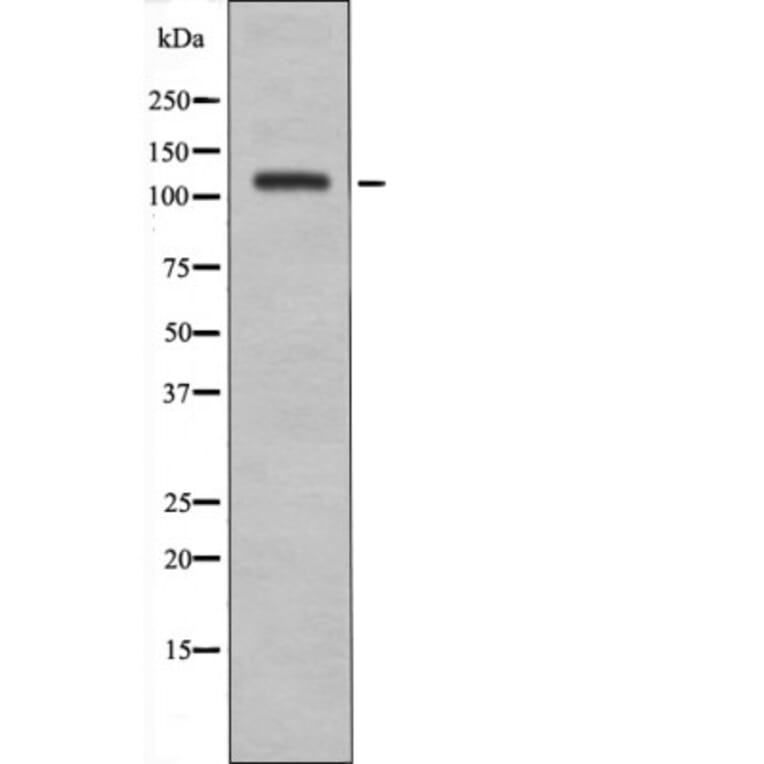 Western blot - EPHA8 (Phospho-Tyr838) Antibody from Signalway Antibody (12499) - Antibodies.com
