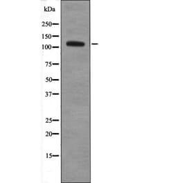 Western blot - EPHA8 (Phospho-Tyr615) Antibody from Signalway Antibody (12500) - Antibodies.com