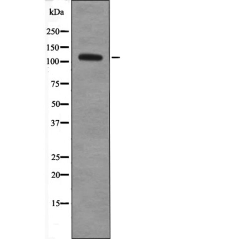 Western blot - EPHA8 (Phospho-Tyr615) Antibody from Signalway Antibody (12500) - Antibodies.com