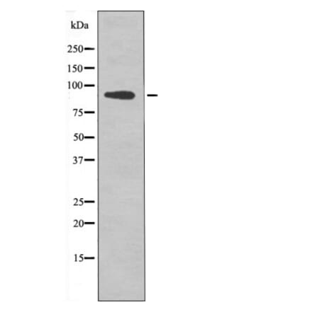 Western blot - FGFR2 (Phospho-Tyr769) Antibody from Signalway Antibody (12503) - Antibodies.com