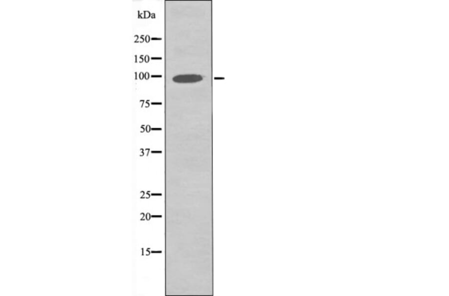 Western blot - FGFR3 (Phospho-Tyr760) Antibody from Signalway Antibody (12504) - Antibodies.com