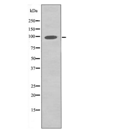 Western blot - FGFR3 (Phospho-Tyr760) Antibody from Signalway Antibody (12504) - Antibodies.com