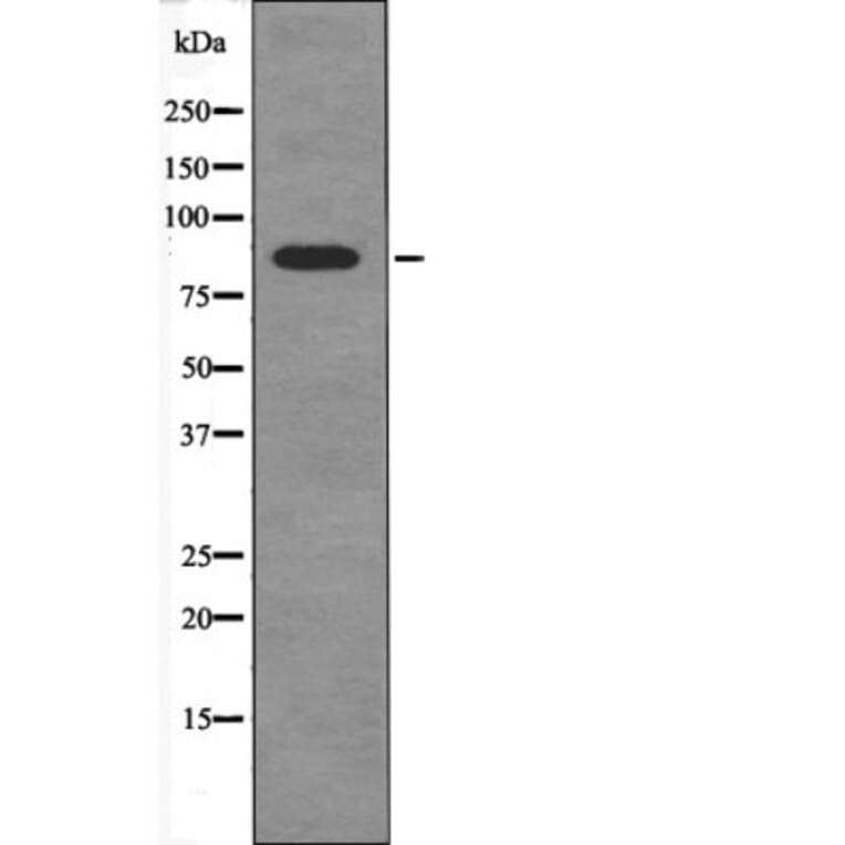 Western blot - FGFR4 (Phospho-Tyr754) Antibody from Signalway Antibody (12505) - Antibodies.com