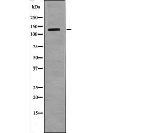 Western blot - TIE1 (Phospho-Tyr1117) Antibody from Signalway Antibody (12535) - Antibodies.com