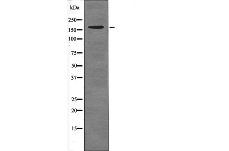 Western blot - c-Ret (Phospho-Tyr981) Antibody from Signalway Antibody (12542) - Antibodies.com