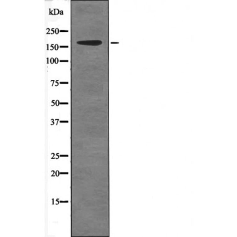 Western blot - c-Ret (Phospho-Tyr981) Antibody from Signalway Antibody (12542) - Antibodies.com