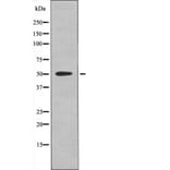 Western blot - RXR-α (Phospho-Ser260) Antibody from Signalway Antibody (12554) - Antibodies.com