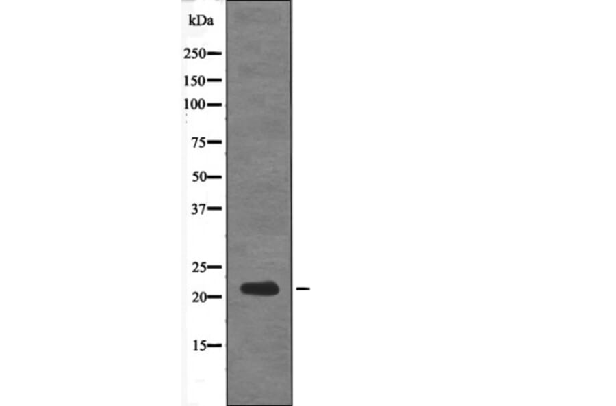 Western blot - DSCR1 (Phospho-Ser108) Antibody from Signalway Antibody (12598) - Antibodies.com