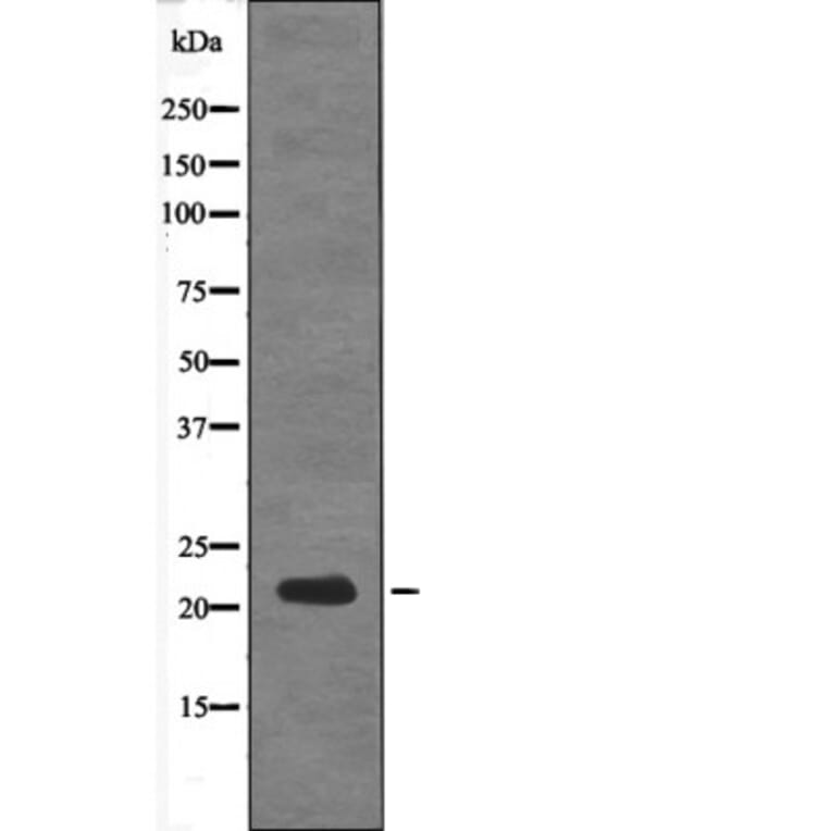 Western blot - DSCR1 (Phospho-Ser108) Antibody from Signalway Antibody (12598) - Antibodies.com