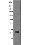 Western blot - DSCR1 (Phospho-Ser108) Antibody from Signalway Antibody (12598) - Antibodies.com