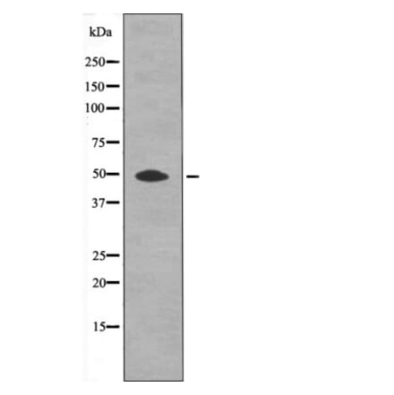 Western blot - HtrA2 (Phospho-Ser212) Antibody from Signalway Antibody (12604) - Antibodies.com