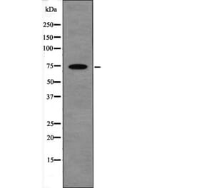 Western blot - LIMK1 (Phospho-Ser310) Antibody from Signalway Antibody (12608) - Antibodies.com