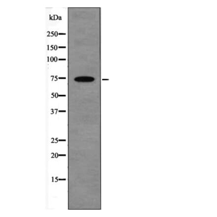 Western blot - LIMK1 (Phospho-Ser310) Antibody from Signalway Antibody (12608) - Antibodies.com