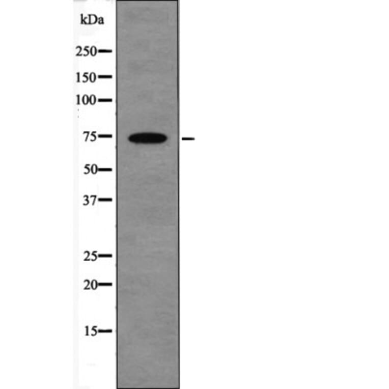 Western blot - LIMK1 (Phospho-Ser310) Antibody from Signalway Antibody (12608) - Antibodies.com