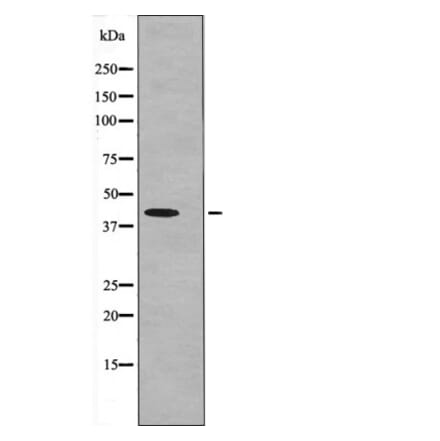 Western blot - MKP-3 (Phospho-Ser197) Antibody from Signalway Antibody (12614) - Antibodies.com