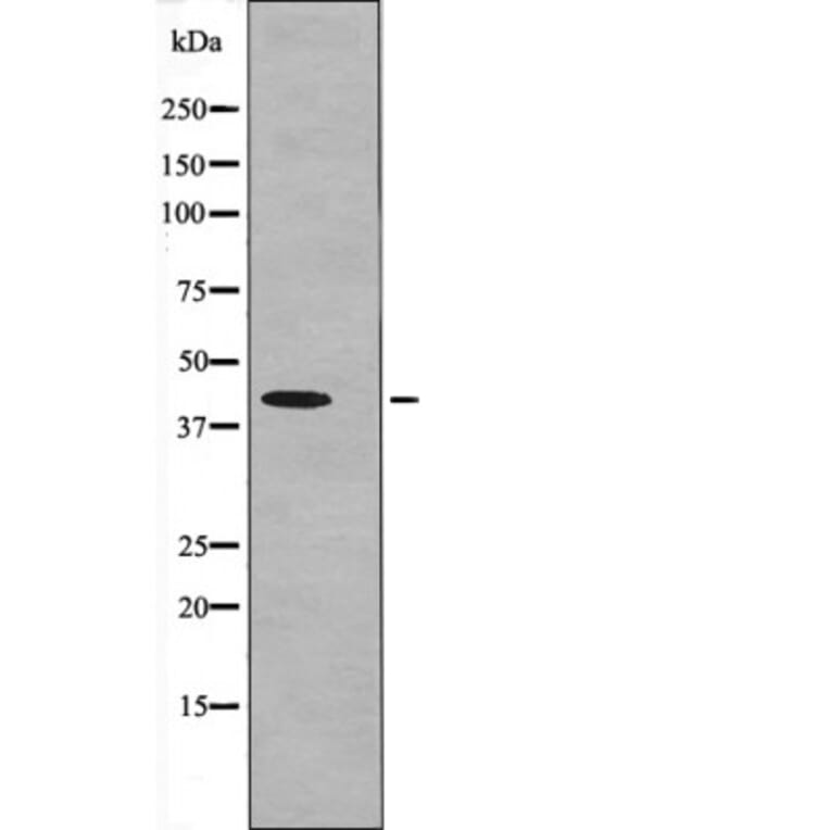 Western blot - MKP-3 (Phospho-Ser197) Antibody from Signalway Antibody (12614) - Antibodies.com