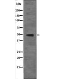 Western blot - RAD23 (Phospho-Ser357) Antibody from Signalway Antibody (12631) - Antibodies.com