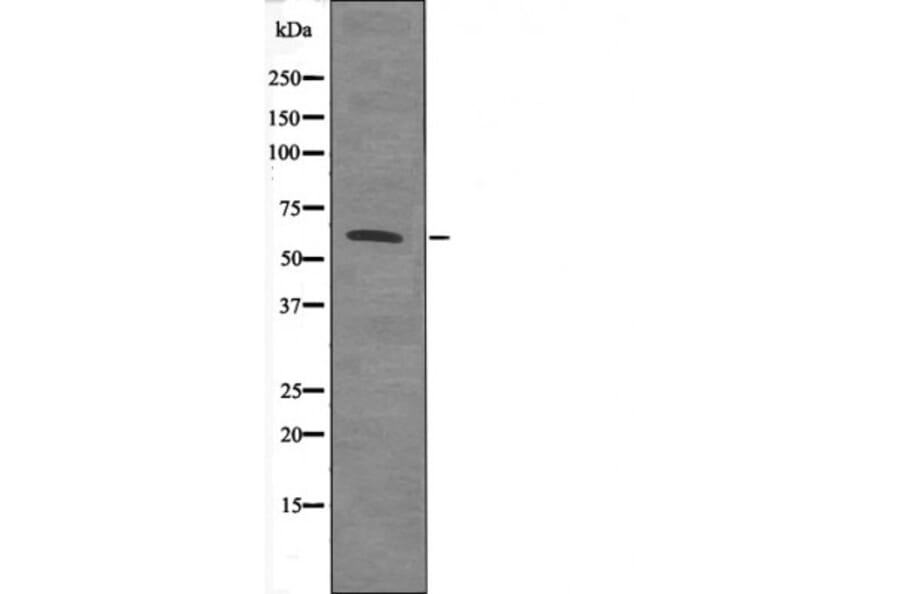 Western blot - Smad4 (Phospho-Thr276) Antibody from Signalway Antibody (12637) - Antibodies.com