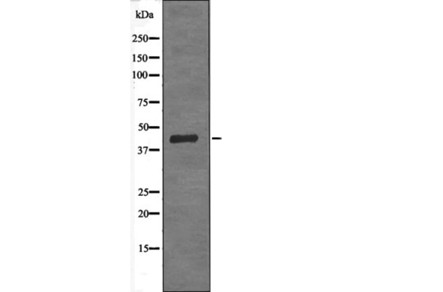 Western blot - SPHK1 (Phospho-Ser225) Antibody from Signalway Antibody (12639) - Antibodies.com