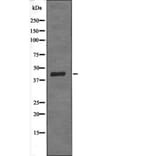 Western blot - SPHK1 (Phospho-Ser225) Antibody from Signalway Antibody (12639) - Antibodies.com