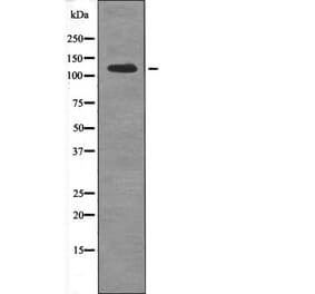 Western blot - USP28 (Phospho-Ser714) Antibody from Signalway Antibody (12653) - Antibodies.com