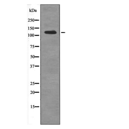 Western blot - USP28 (Phospho-Ser714) Antibody from Signalway Antibody (12653) - Antibodies.com