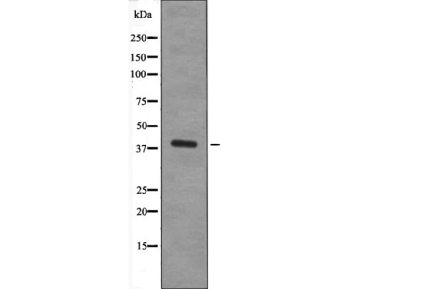 Western blot - XRCC4 (Phospho-Ser260) Antibody from Signalway Antibody (12656) - Antibodies.com