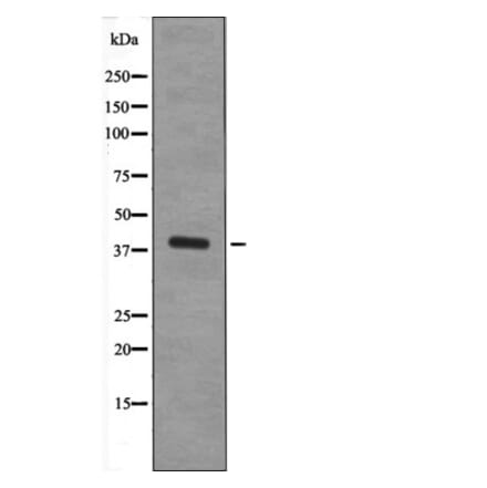 Western blot - XRCC4 (Phospho-Ser260) Antibody from Signalway Antibody (12656) - Antibodies.com
