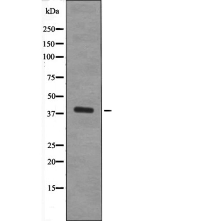 Western blot - XRCC4 (Phospho-Ser260) Antibody from Signalway Antibody (12656) - Antibodies.com