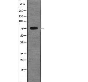 Western blot - ALOX5 (Phospho-Ser663) Antibody from Signalway Antibody (12671) - Antibodies.com