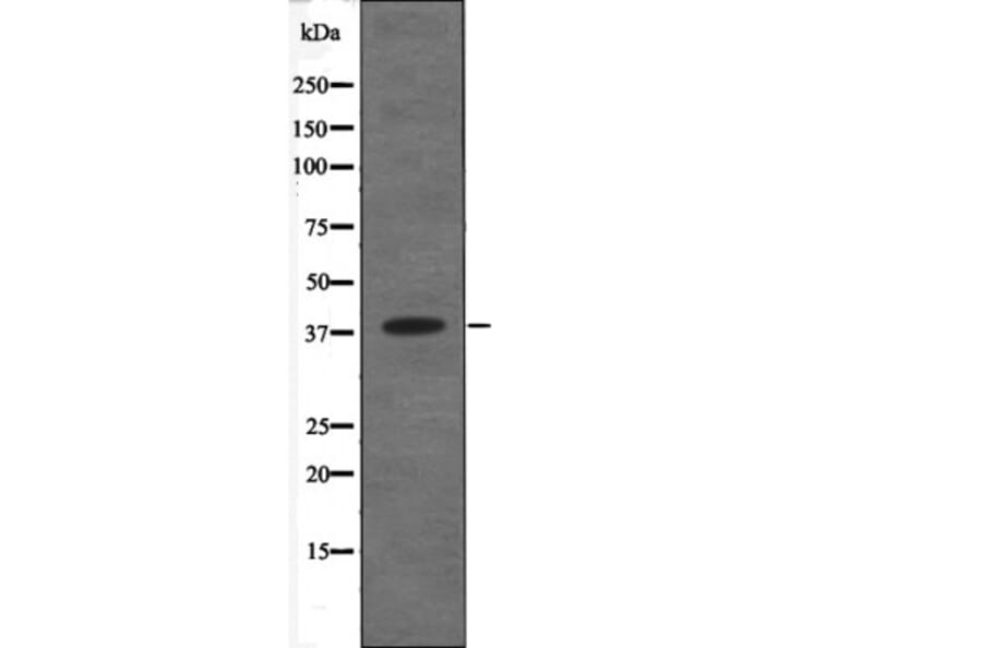 Western blot - C5AR1 (Phospho-Ser334) Antibody from Signalway Antibody (12673) - Antibodies.com