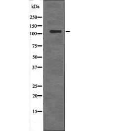 Western blot - DDEF2 (Phospho-Ser701) Antibody from Signalway Antibody (12678) - Antibodies.com