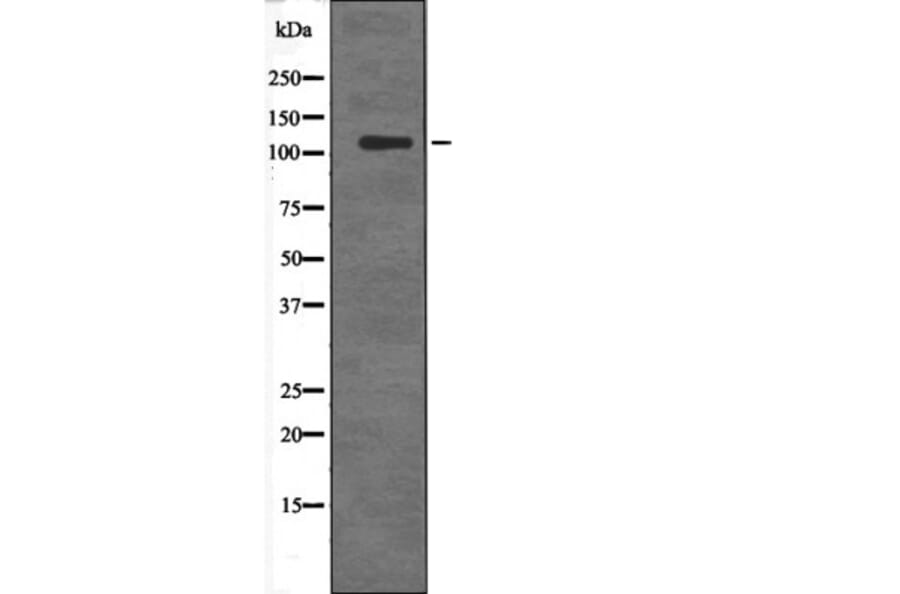 Western blot - DDEF2 (Phospho-Ser701) Antibody from Signalway Antibody (12678) - Antibodies.com