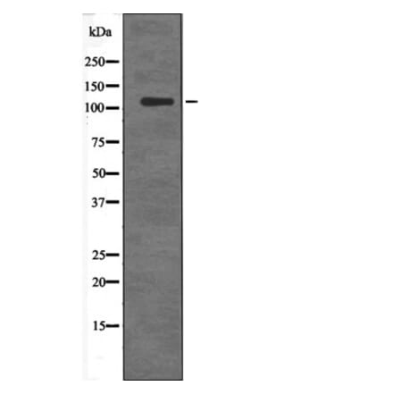 Western blot - DDEF2 (Phospho-Ser701) Antibody from Signalway Antibody (12678) - Antibodies.com